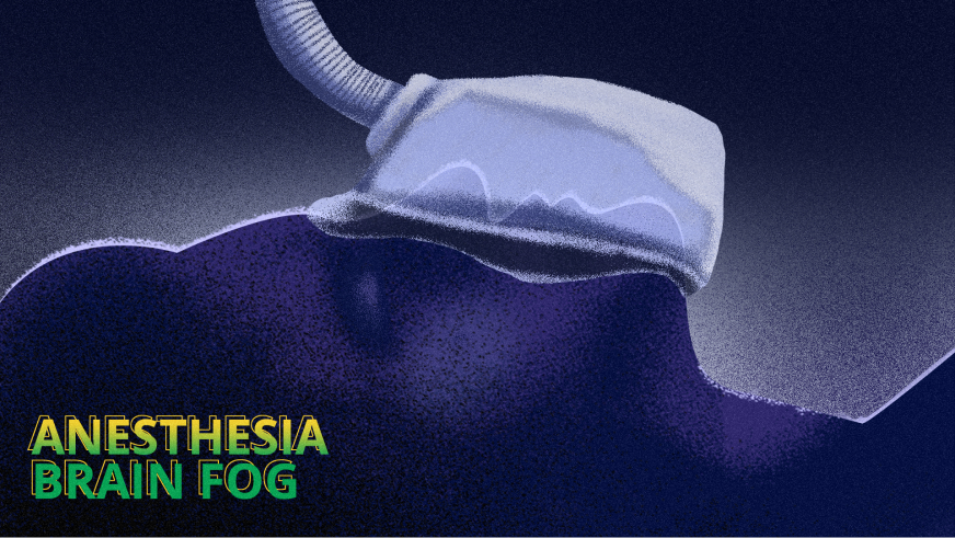 How to Get Rid of Brain Fog after Surgery (from Anesthesia)?